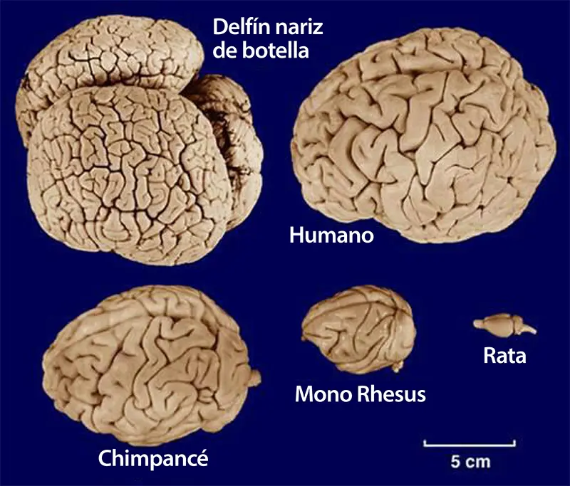 Que tenía de especial el cerebro de Albert Einstein 4 Que tenía de especial el cerebro de Albert Einstein