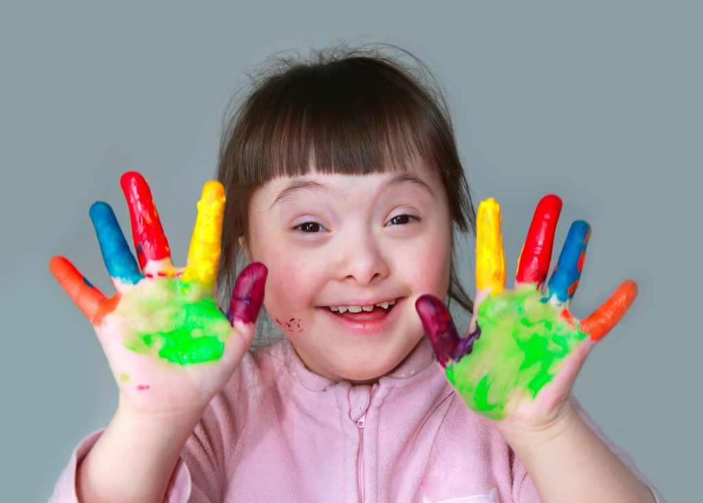 Cómo se puede ayudar a un niño con síndrome de Down 4 Cómo se puede ayudar a un niño con síndrome de Down