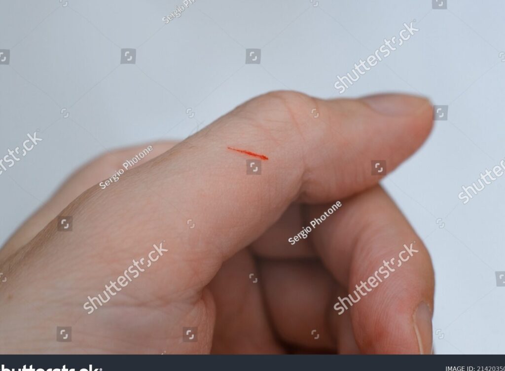 una imagen de una mano sosteniendo un iman cerca de una pequena herida en el dedo